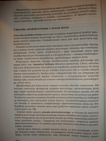 patologia_ukl_krazenia - DSC08415.JPG